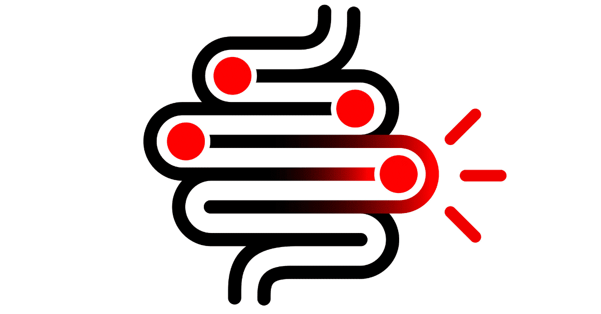 Intestinal Dysfunction: Symptoms, Tests, and Treatments