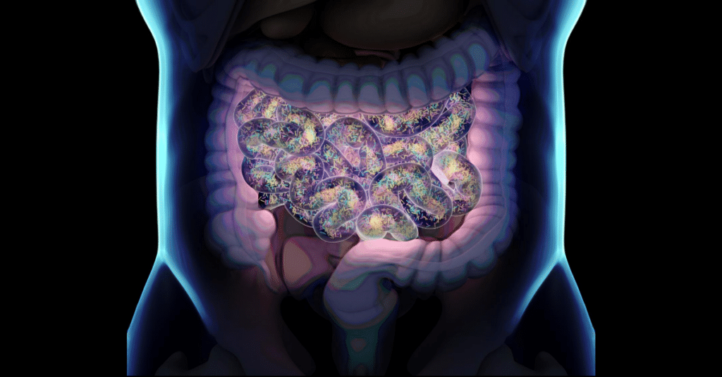 Small Intestine Bacterial Overgrowth (SIBO) in Lyme Disease